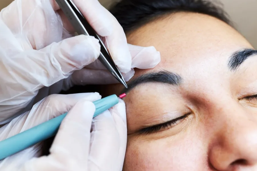Electrolysis training practice, eyebrow area treatment